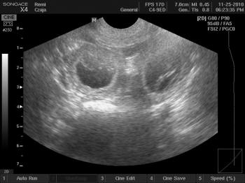 around 27th day of pregnancy ....We're happy to present first ultrasound picture of puppies the first yellow puppies that are planned to arrive at the end of December 2010..:)