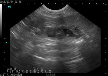 Below is the first ultrasound photo of the puppies which was taken in 22nd day of pregnancy:)
